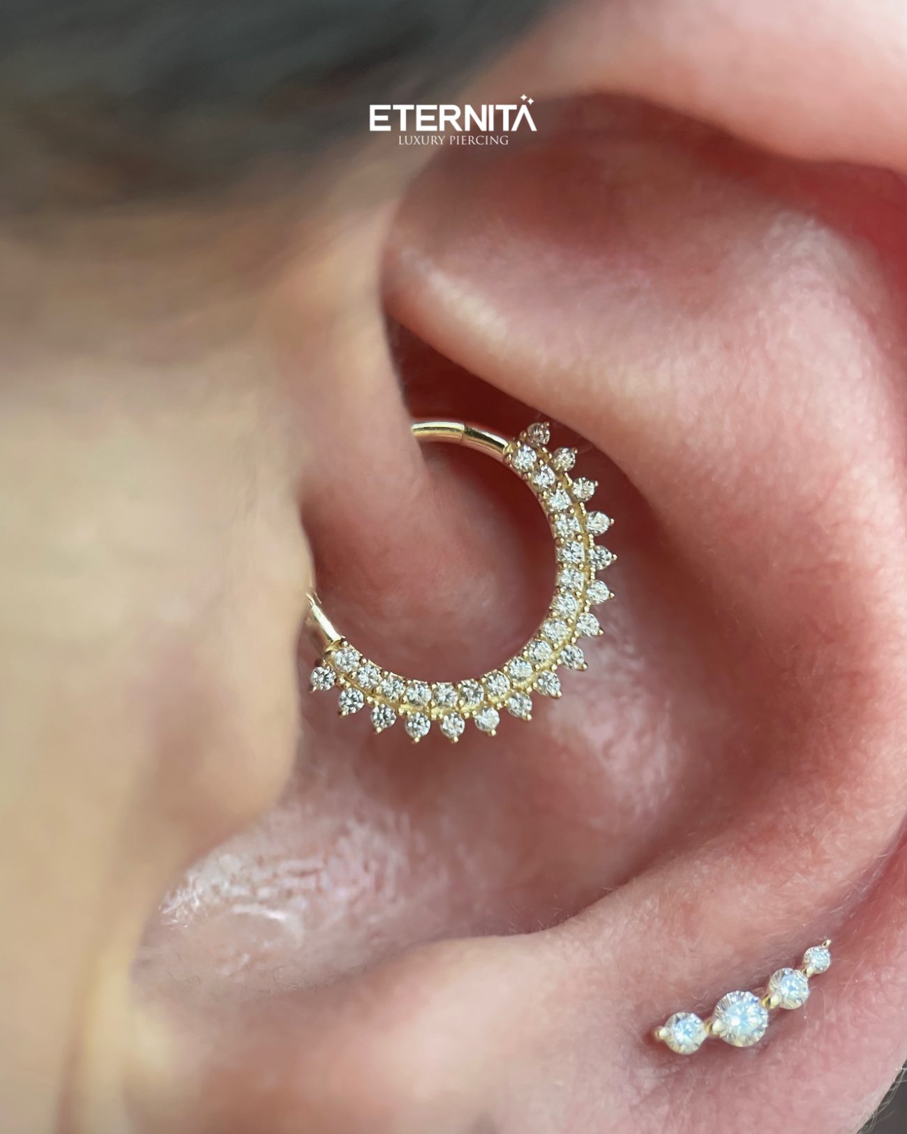Daith serti, macro